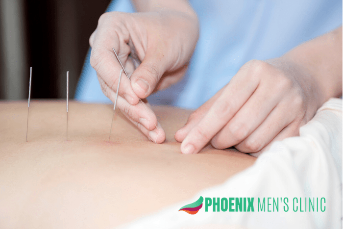 How is Acupuncture for Infertility an Effective Treatment in Men? | Men’s Health Clinic in Phoenix AZ